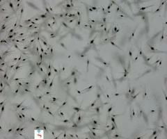 Vannamei Seed (post larvae)